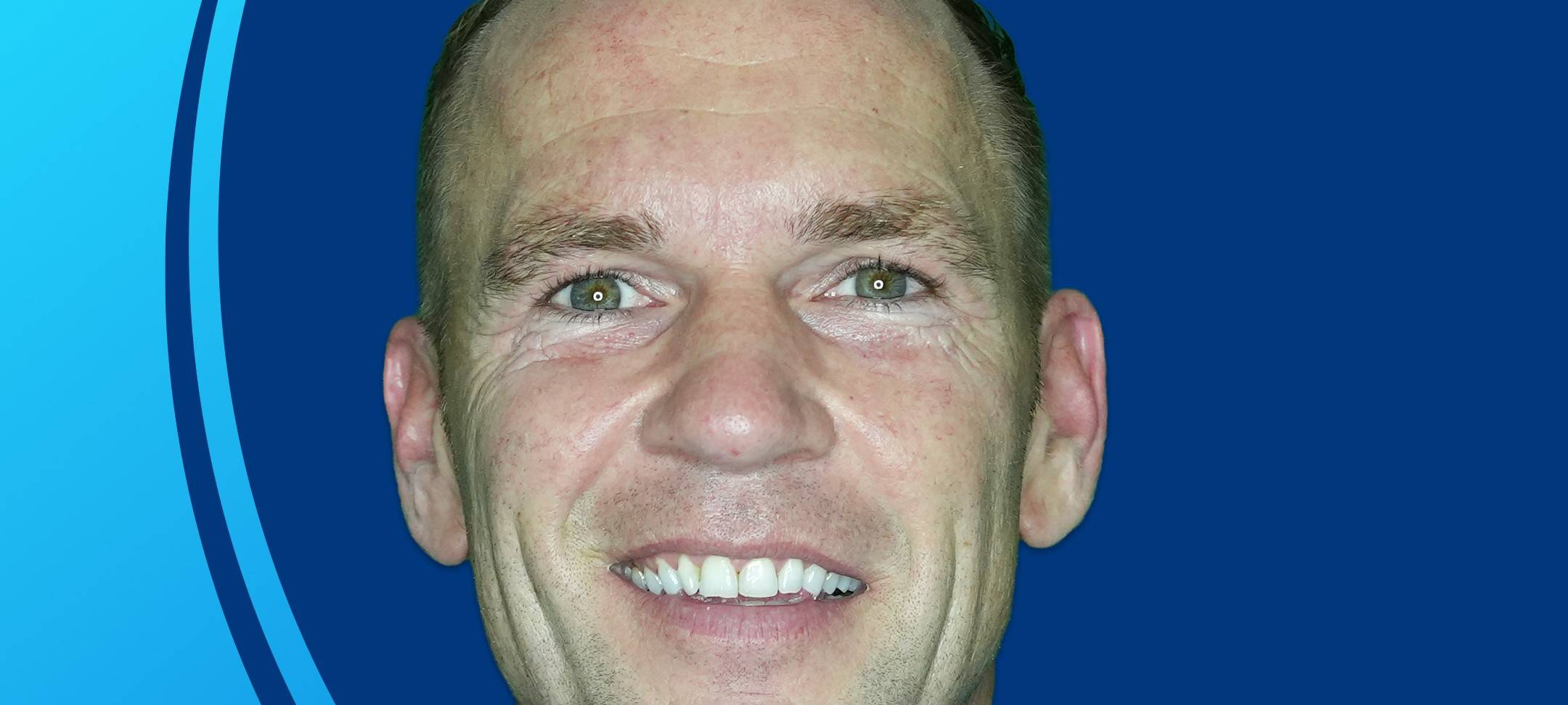 Trainerteam vom FC Remscheid bekommt Verstärkung